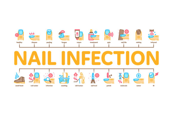 Nail Infection Disease Minimal: Visual Assets for Health Communication and Design