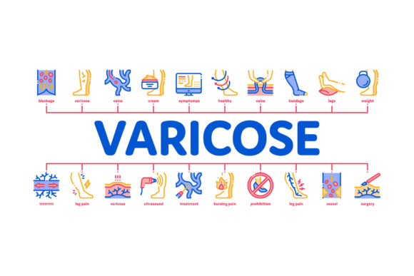 Visualizing Varicose Veins Disease Minimal: Bridging Medical Accuracy and Design Simplicity